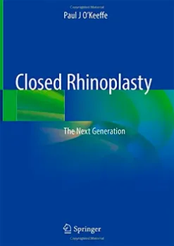 Imagem de Closed Rhinoplasty: The Next Generation