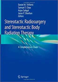 Imagem de Stereotactic Radiosurgery and Stereotactic Body Radiation Therapy