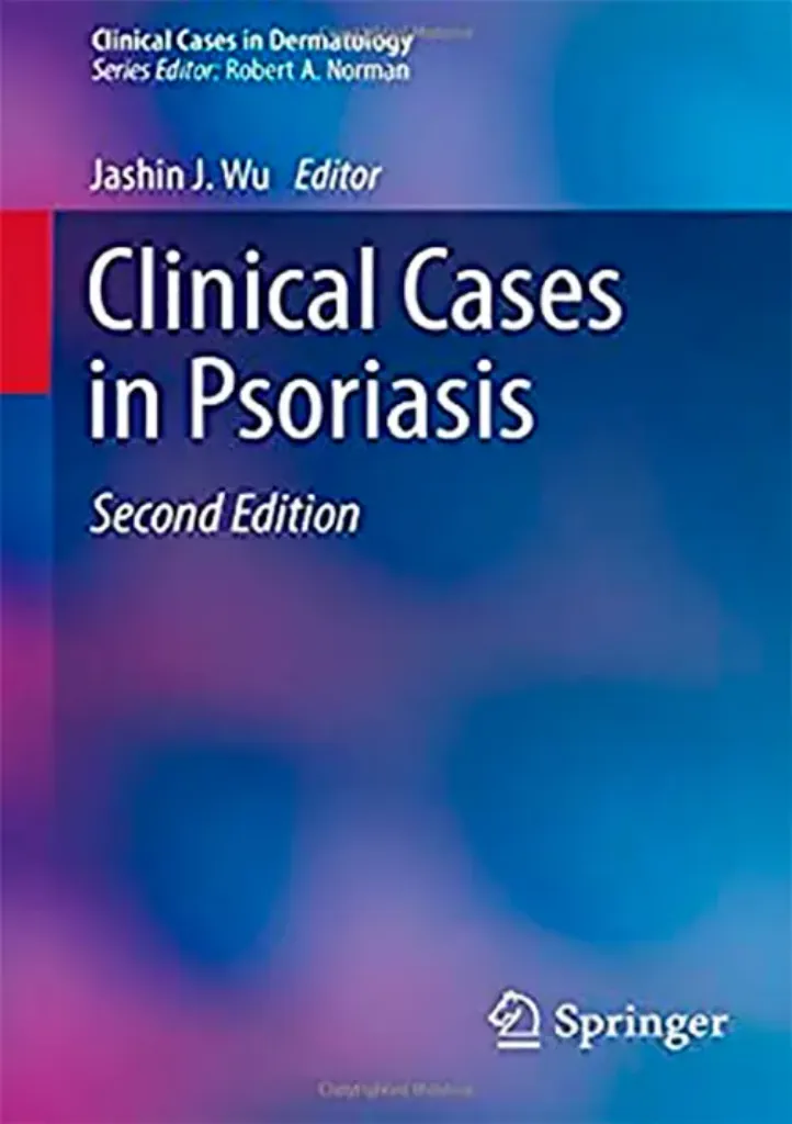 Imagem de Clinical Cases in Psoriasis