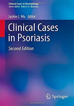 Imagem de Clinical Cases in Psoriasis