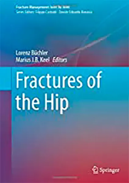 Imagem de Fractures of the Hip