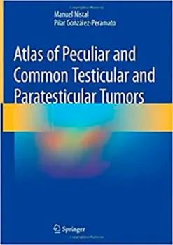Imagem de Atlas of Peculiar and Common Testicular and Paratesticular Tumors