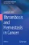 Imagem de Thrombosis and Hemostasis in Cancer
