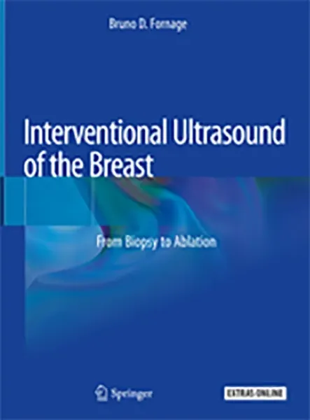 Imagem de Interventional Ultrasound of the Breast: From Biopsy to Ablation