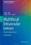 Imagem de Multifocal Intraocular Lenses: The Art and the Practice
