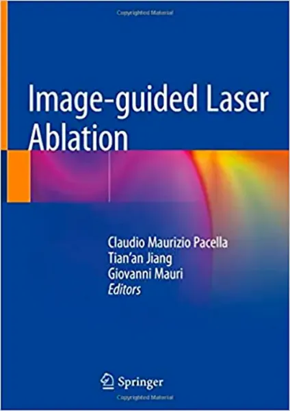 Imagem de Image-Guided Laser Ablation