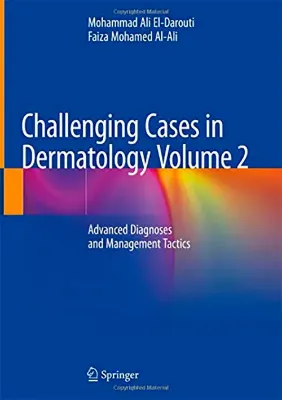 Picture of Book Challenging Cases in Dermatology: Advanced Diagnoses and Management Tactics Vol. 2