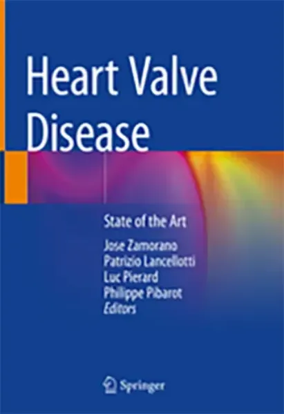 Imagem de Heart Valve Disease: State of the Art