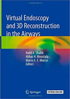 Imagem de Virtual Endoscopy and 3D Reconstruction in the Airways