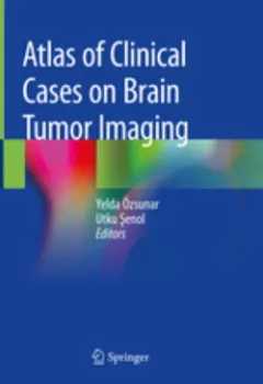 Imagem de Atlas of Clinical Cases on Brain Tumor Imaging