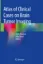 Imagem de Atlas of Clinical Cases on Brain Tumor Imaging