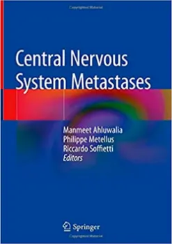 Picture of Book Central Nervous System Metastases