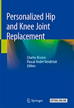 Imagem de Personalized Hip and Knee Joint Replacement