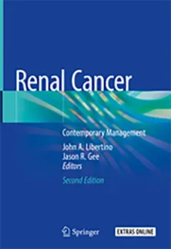 Imagem de Renal Cancer: Contemporary Management