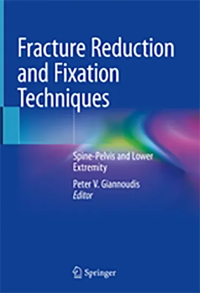 Imagem de Fracture Reduction and Fixation Techniques: Spine-Pelvis and Lower Extremity