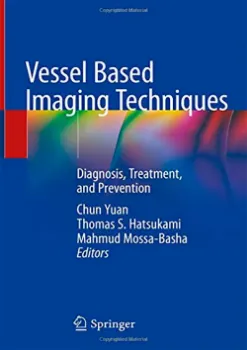 Imagem de Vessel Based Imaging Techniques: Diagnosis, Treatment, and Prevention