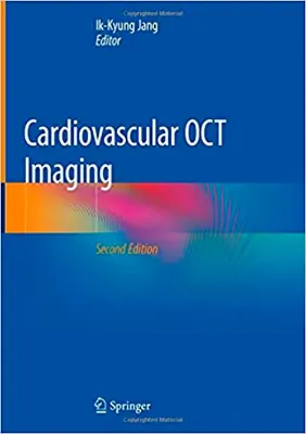 Imagem de Cardiovascular OCT Imaging