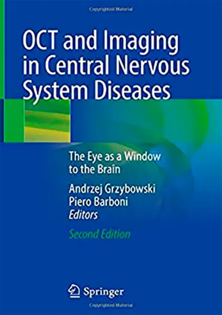 Imagem de OCT and Imaging in Central Nervous System Diseases: The Eye as a Window to the Brain