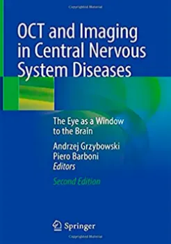 Imagem de OCT and Imaging in Central Nervous System Diseases: The Eye as a Window to the Brain