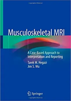 Imagem de Musculoskeletal MRI: A Case-Based Approach to Interpretation and Reporting