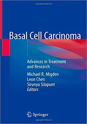 Imagem de Basal Cell Carcinoma: Advances in Treatment and Research