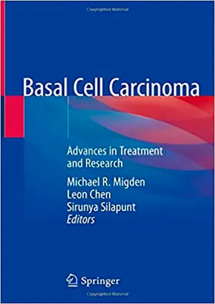 Imagem de Basal Cell Carcinoma: Advances in Treatment and Research
