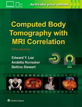 Picture of Book Computed Tomography: Approaches, Applications, and Operations