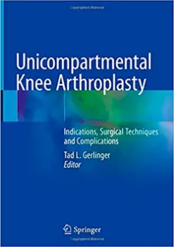Imagem de Unicompartmental Knee Arthroplasty: Indications, Surgical Techniques and Complications