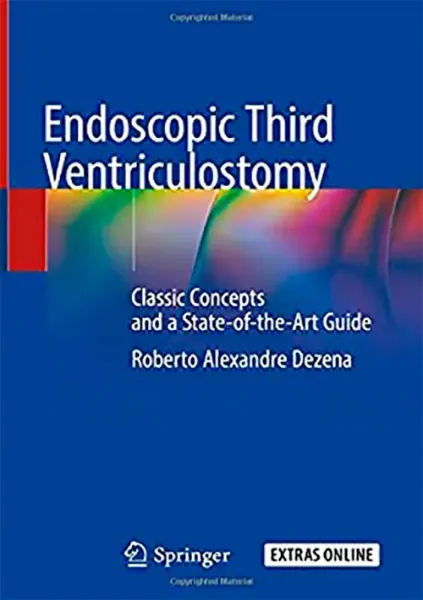 Imagem de Endoscopic Third Ventriculostomy: Classic Concepts and a State-of-the-Art Guide