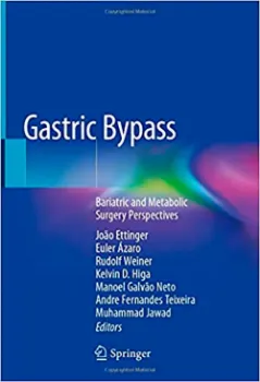 Imagem de Gastric Bypass: Bariatric and Metabolic Surgery Perspectives