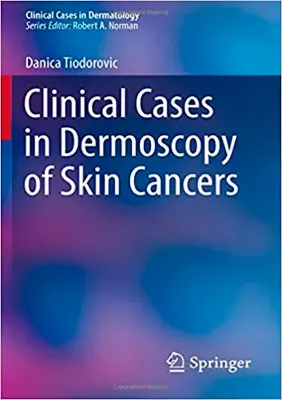 Picture of Book Clinical Cases in Dermoscopy of Skin Cancers