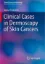 Imagem de Clinical Cases in Dermoscopy of Skin Cancers