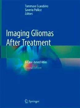 Imagem de Imaging Gliomas After Treatment: A Case-Based Atlas