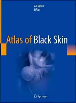 Imagem de Atlas of Black Skin