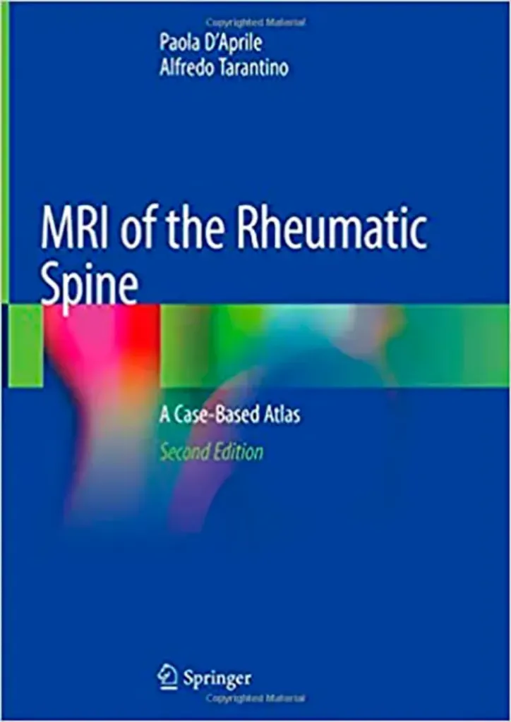 Imagem de MRI of the Rheumatic Spine: A Case-Based Atlas