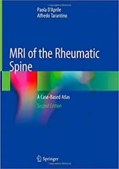 Imagem de MRI of the Rheumatic Spine: A Case-Based Atlas