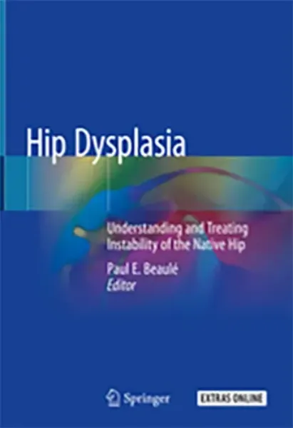 Imagem de Hip Dysplasia: Understanding and Treating Instability of the Native Hip