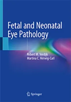 Imagem de Fetal and Neonatal Eye Pathology