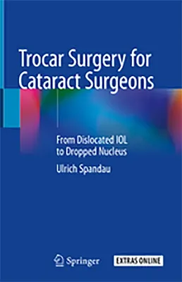 Imagem de Trocar Surgery for Cataract Surgeons: From Dislocated IOL to Dropped Nucleus