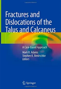 Imagem de Fractures and Dislocations of the Talus and Calcaneus: A Case-Based Approach