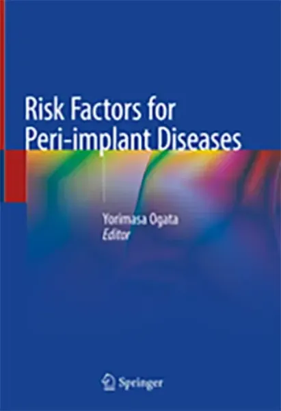 Imagem de Risk Factors for Peri-implant Diseases