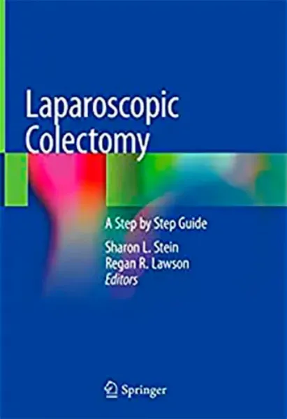 Imagem de Laparoscopic Colectomy: A Step by Step Guide