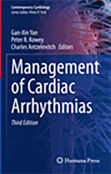 Imagem de Management of Cardiac Arrhythmias