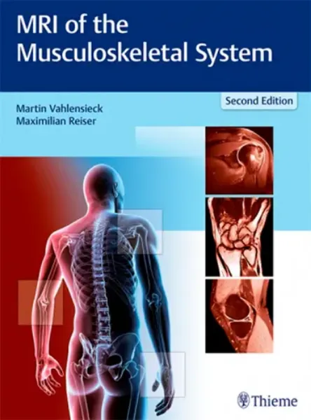 Imagem de MRI of the Musculoskeletal System