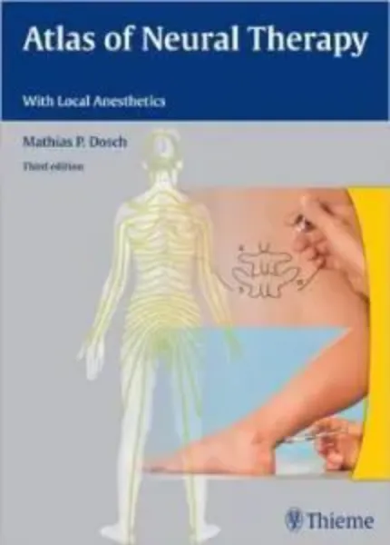 Imagem de Atlas Neural Therapy With Local Anesthetics