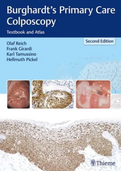 Imagem de Burghartdt's Primary Care Colposcopy: Textbook and Atlas