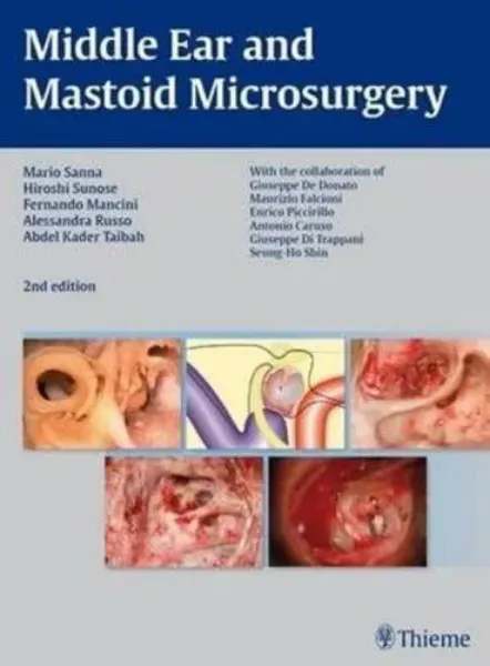 Imagem de Middle Ear Mastoid Microsurgery