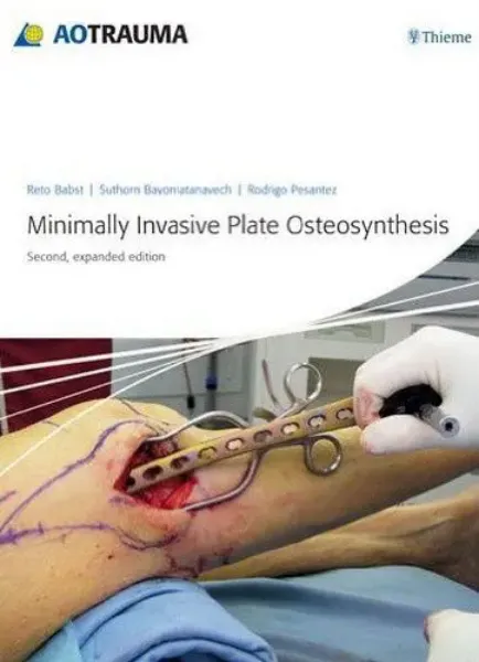 Imagem de Minimally Invasive Plate Osteosynthesis