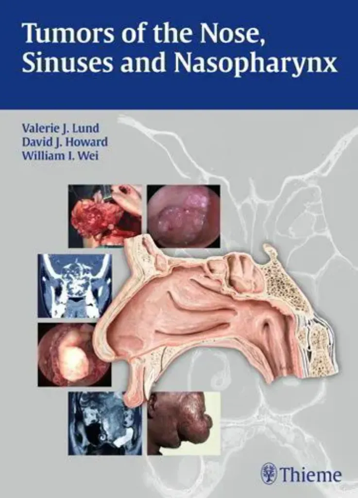 Imagem de Tumors of the Nose, Sinuses and Nasopharynx