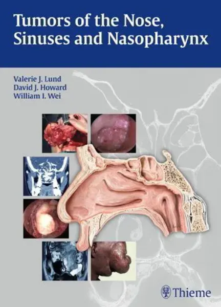Imagem de Tumors of the Nose, Sinuses and Nasopharynx
